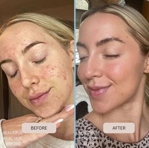 Veluvie Glass Skin Collagen Mask