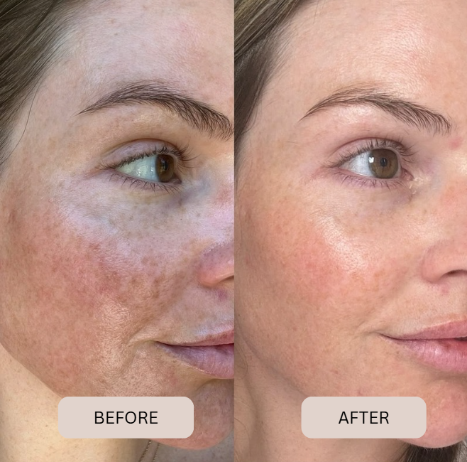 Veluvie Glass Skin Collagen Mask