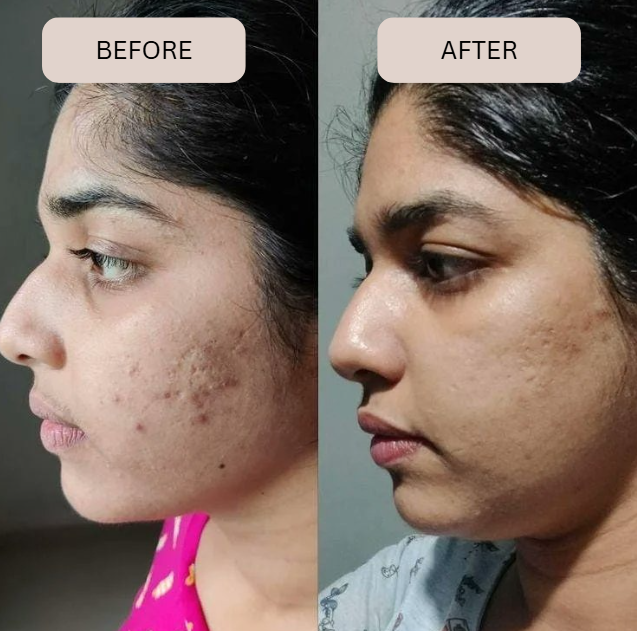 Veluvie Glass Skin Collagen Mask