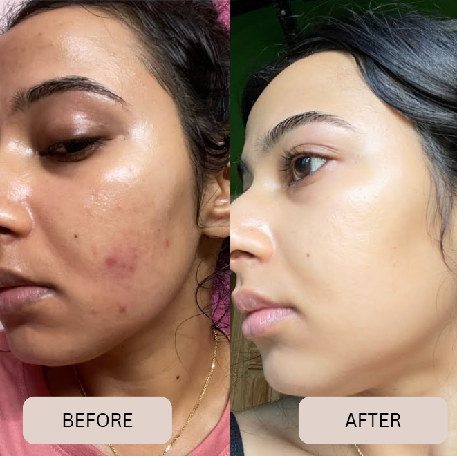 Veluvie Glass Skin Collagen Mask